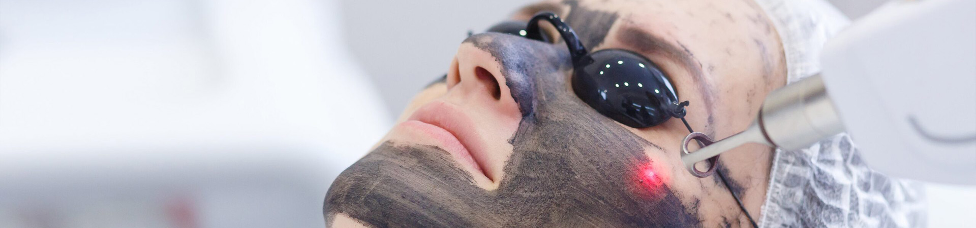 Hollywood Carbon Laser Peel